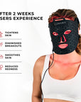 VISO - FDA Certified Red Light Therapy Mask